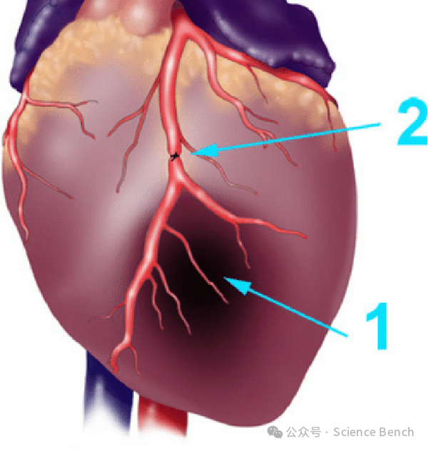 心肌梗死模型-【动物造模】 - 知乎